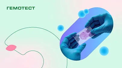 Лаборатория Гемотест открыла Центр морфологических исследований
